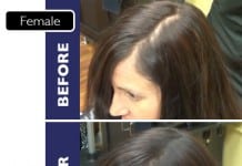 FIXPLANT Keratin Hair Building Fibers Becomes Most Sought-after Product by Hair Loss Sufferers