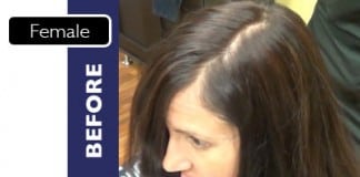 FIXPLANT Keratin Hair Building Fibers Becomes Most Sought-after Product by Hair Loss Sufferers