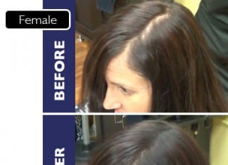 FIXPLANT Keratin Hair Building Fibers Becomes Most Sought-after Product by Hair Loss Sufferers