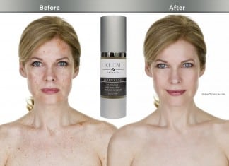 Four Vitamin C Serums to Try