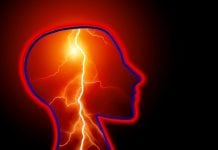 Face the Facts: Stroke is Treatable