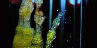Stem Cells Linked to New Treatment of Diabetes