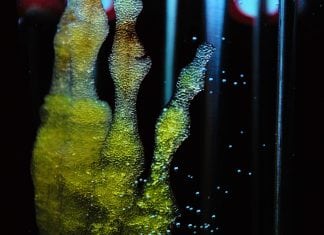 Stem Cells Linked to New Treatment of Diabetes