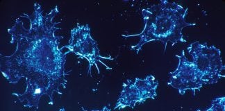 Cancer Therapy Is Double-edged Sword; How to Blunt It