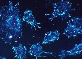 Cancer Therapy Is Double-edged Sword; How to Blunt It