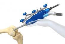 First Robotic-Assisted Knee Surgeries in Middle East