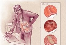 Incidence of Inflammatory Bowel Disease on the Rise
