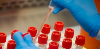 Dubai Announces UAE’s First Full Genome Sequencing of COVID-19 Virus