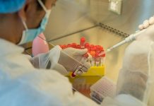 Unilabs Launches New Covid-19 Test to Identify The Delta Variant Unilabs has created a new PCR test that can specifically identify the new, more infectious Delta variant.