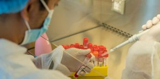 Unilabs Launches New Covid-19 Test to Identify The Delta Variant Unilabs has created a new PCR test that can specifically identify the new, more infectious Delta variant.
