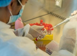 Unilabs Launches New Covid-19 Test to Identify The Delta Variant Unilabs has created a new PCR test that can specifically identify the new, more infectious Delta variant.